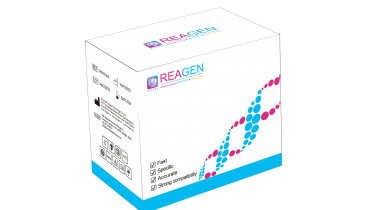 登革病毒核酸檢測試劑盒(熒光PCR法)